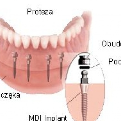 m-imtec